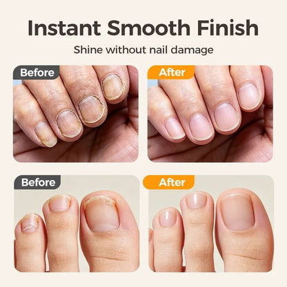 🔥🔥Last Day 50% OFF -✂️ 2-in-1 Smart Electric Nail Clipper & Polisher – Anti-Pinch Safety & LED Light 💅
